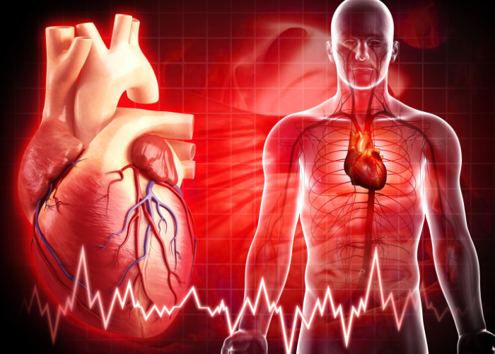 infarto-fulminante:-o-que-e?-quais-sintomas?-quais-sao-as-possiveis-causas-que-leva-o-obito-do-paciente?