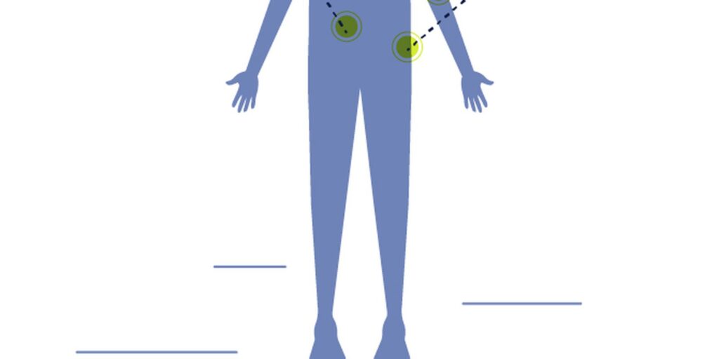pacientes-com-neuroblastoma-aguardam-inclusao-de-medicamento-no-sus
