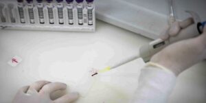 exames-descartam-ebola-em-imigrante-da-republica-democratica-do-congo