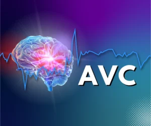 neurocirurgiao-revela-habitos-que-prejudicam-vasos-sanguineos-e-aumentam-chances-de-avc.