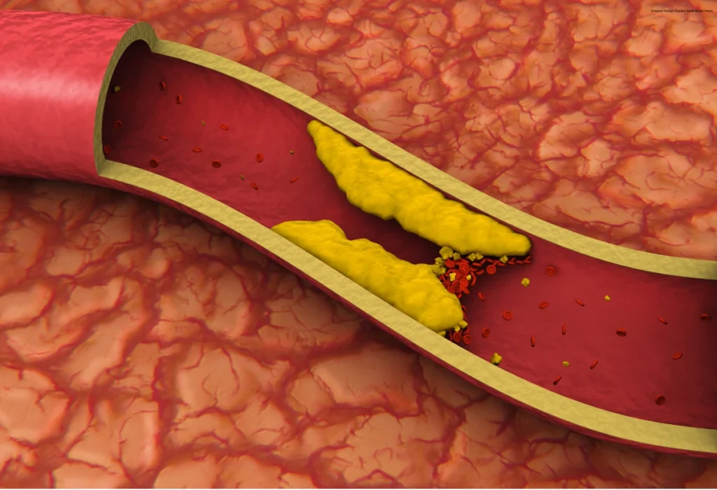 conheca-os-vegetais-que-ajudam-a-proteger-as-arterias,-reduzir-pressao-arterial-e-prevenir-aterosclerose