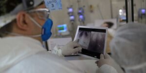 broncopneumonia:-entenda-quadro-que-causou-internacao-de-bolsonaro