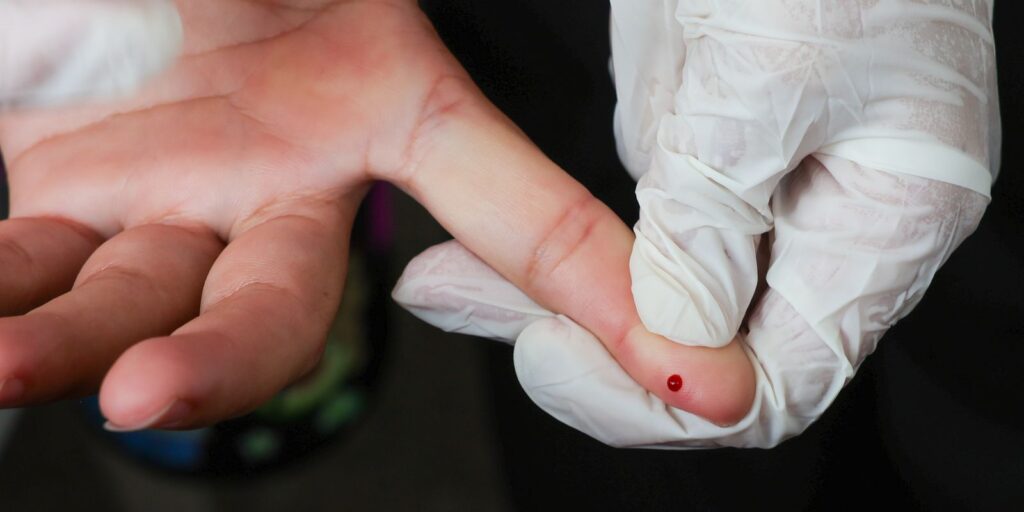 Teste rápido de dengue passa a integrar tabela do SUS