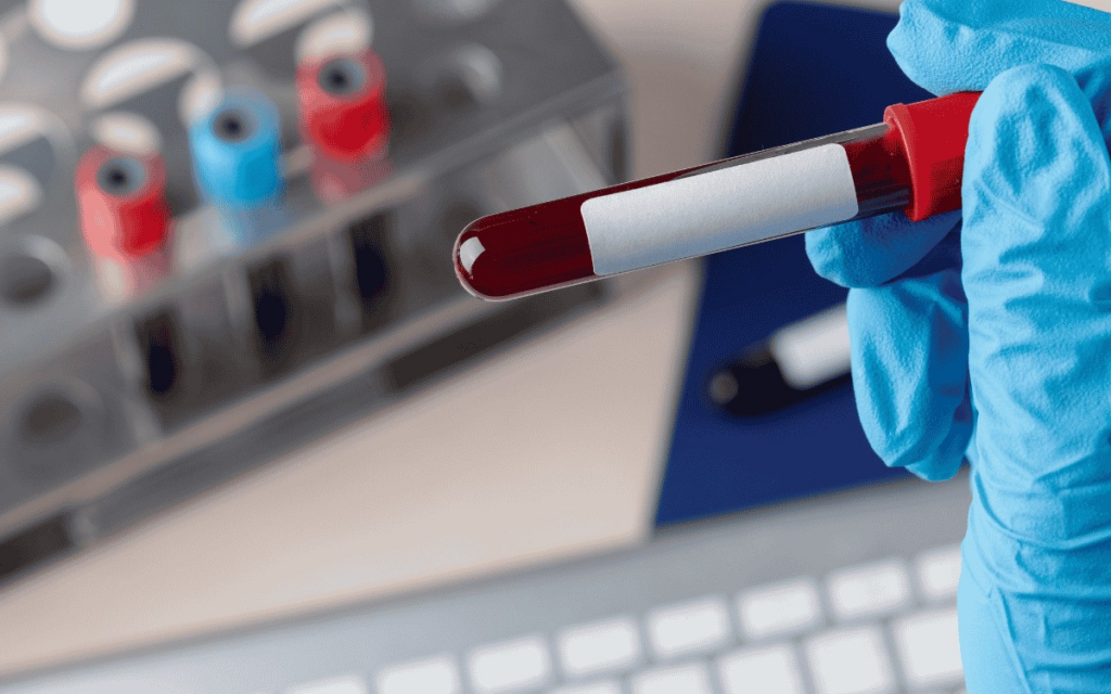 Rondônia tem 2ª maior taxa de hepatite B do Brasil e Porto Velho lidera entre capitais